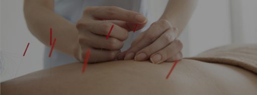 Acupuncture One Treatment