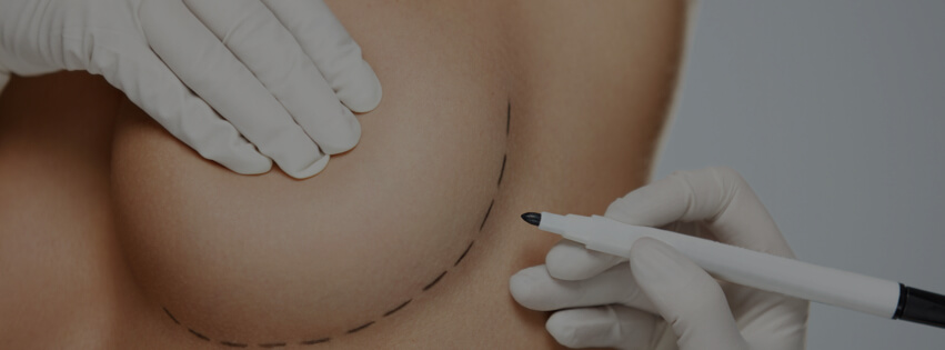 Breast Augmentation