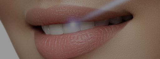 Teeth Whitening Laser