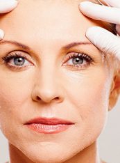 Cosmetic Procedures, Brow Lift