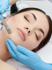 Diamond MicroDermabrasion Blog