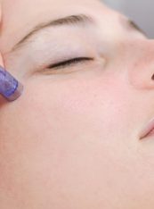 MicroNeedling