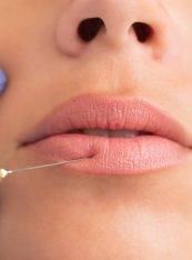 Close-up of woman receiving botox