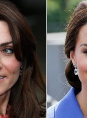 kate-middleton-baby-Botox