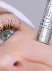 Microdermabrasion Treatment in Atlanta, GA