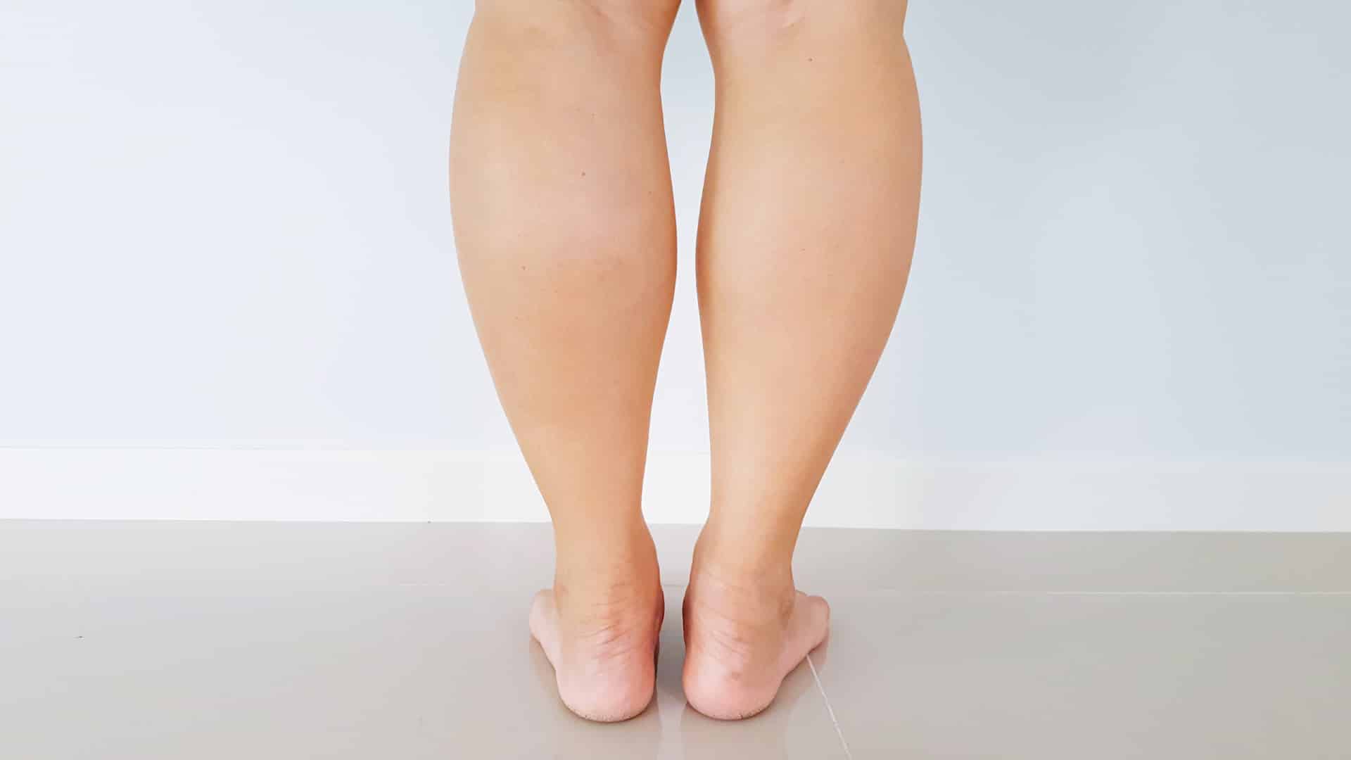 Calf Liposuction