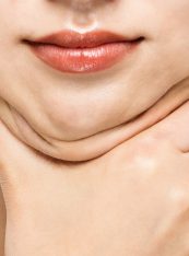 Neck Lift, Before and After, Tummy Tuck, Liposuction, Double Chin, Neck Fat, Jaw Fat
