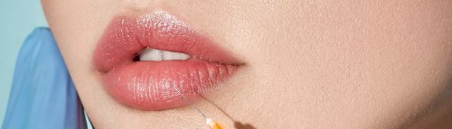 Lip Augmentation